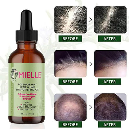 Oil Rosemary Mint Hair Strengthening Oil Nourishing Treatment for Split Ends and Dry Mielle Organics Hair - Yara fashion  4406378 Oil Rosemary Mint Hair Strengthening Oil Nourishing Treatment for Split Ends and Dry Mielle Organics Hair 