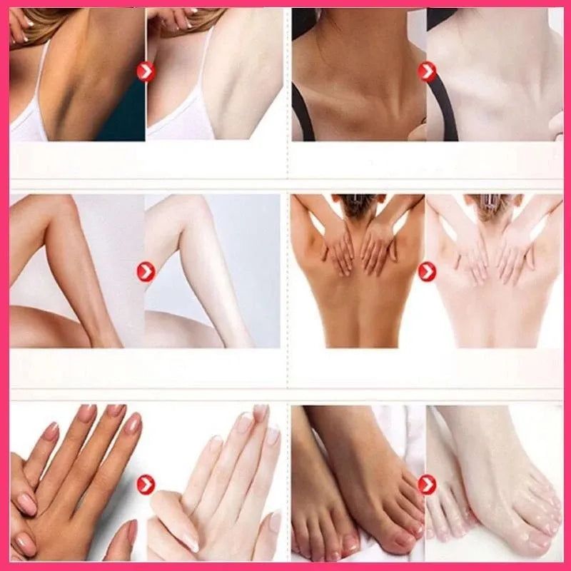 Private body whitening cream armpit buttock nipple private area - Yara fashion  11769200 Private body whitening cream armpit buttock nipple private area 