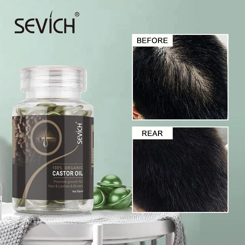 Sevich 2PCS/Set Ginger Hair Growth Capsules Set Hair Vitamin Oil For Hair Loss Repair Treatment Damaged Hair Black Hair Serum - Yara fashion  80263203 Sevich 2PCS/Set Ginger Hair Growth Capsules Set Hair Vitamin Oil For Hair Loss Repair Treatment Damaged Hair Black Hair Serum 